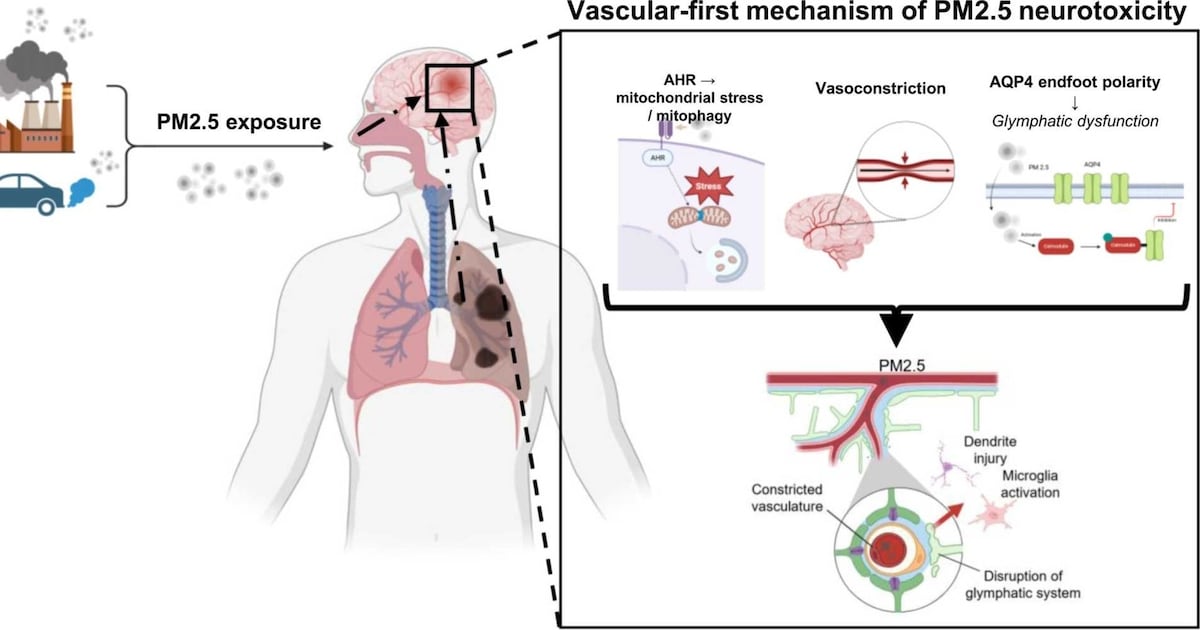 초미세먼지, 뇌혈관 기능 떨어뜨려 뇌 건강 해친다 - 뉴스 썸네일 이미지