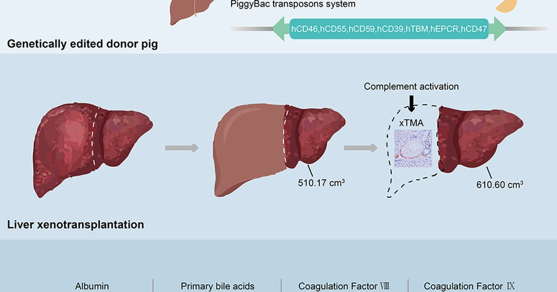 Genetically edited pig kidney sets US record by lasting 271 days in patient - CHOSUNBIZ