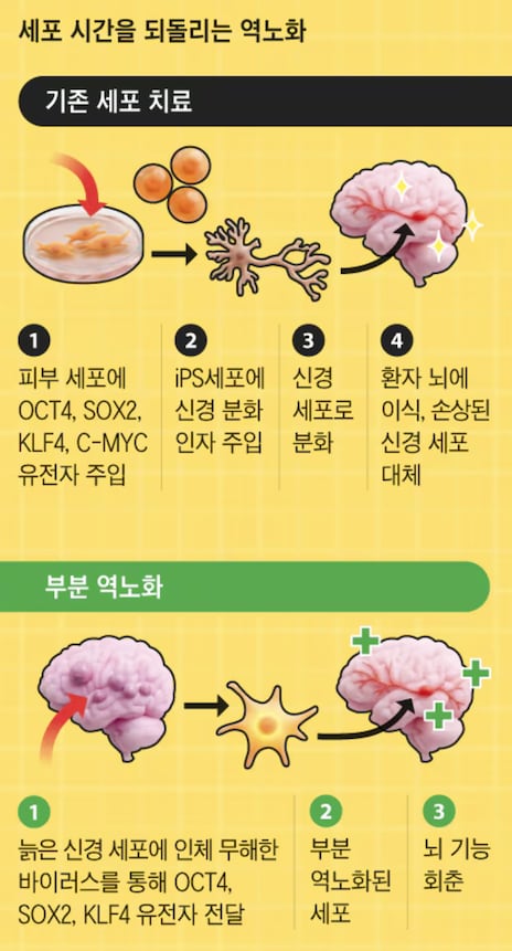 細胞若返りが臨床入り視力回復や再生進む - ChosunBiz