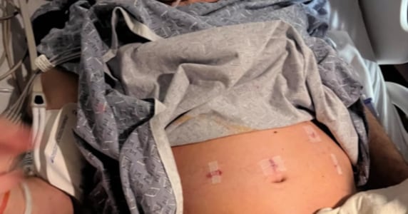 Perez Hilton Beats Sepsis with Faith, Lifestyle Shift