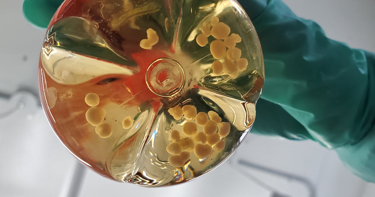 동물실험 넘어 치료제로 진화...국내 기업들 '오가노이드' 산업화에 도... - 뉴스 썸네일 이미지