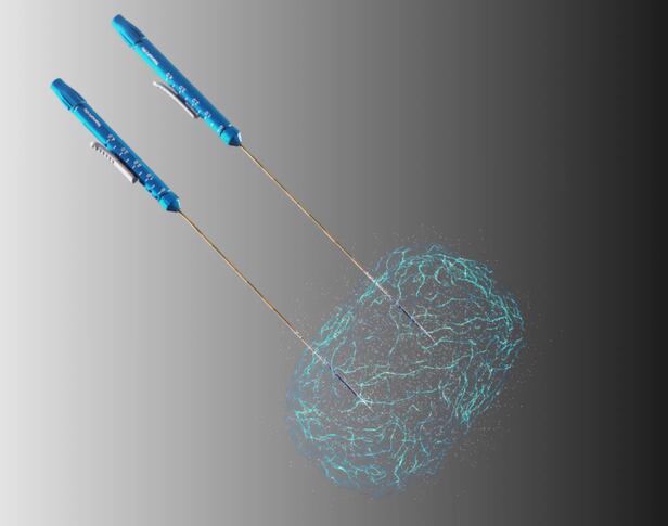 2024년말 FDA가 승인한 앤지오다이내믹스(AngioDynamics)의 암 최소침습 치료기기 나노나이프. /AngioDynamics