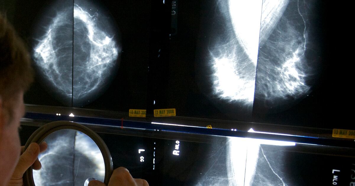 '시한부' 판정 받고도 장수한 '슈퍼생존자'에게서 암 치료 새 길 찾... - 뉴스 썸네일 이미지