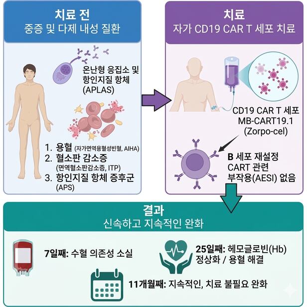 CAR-Tで自己免疫疾患3種を同時完治 - ChosunBiz