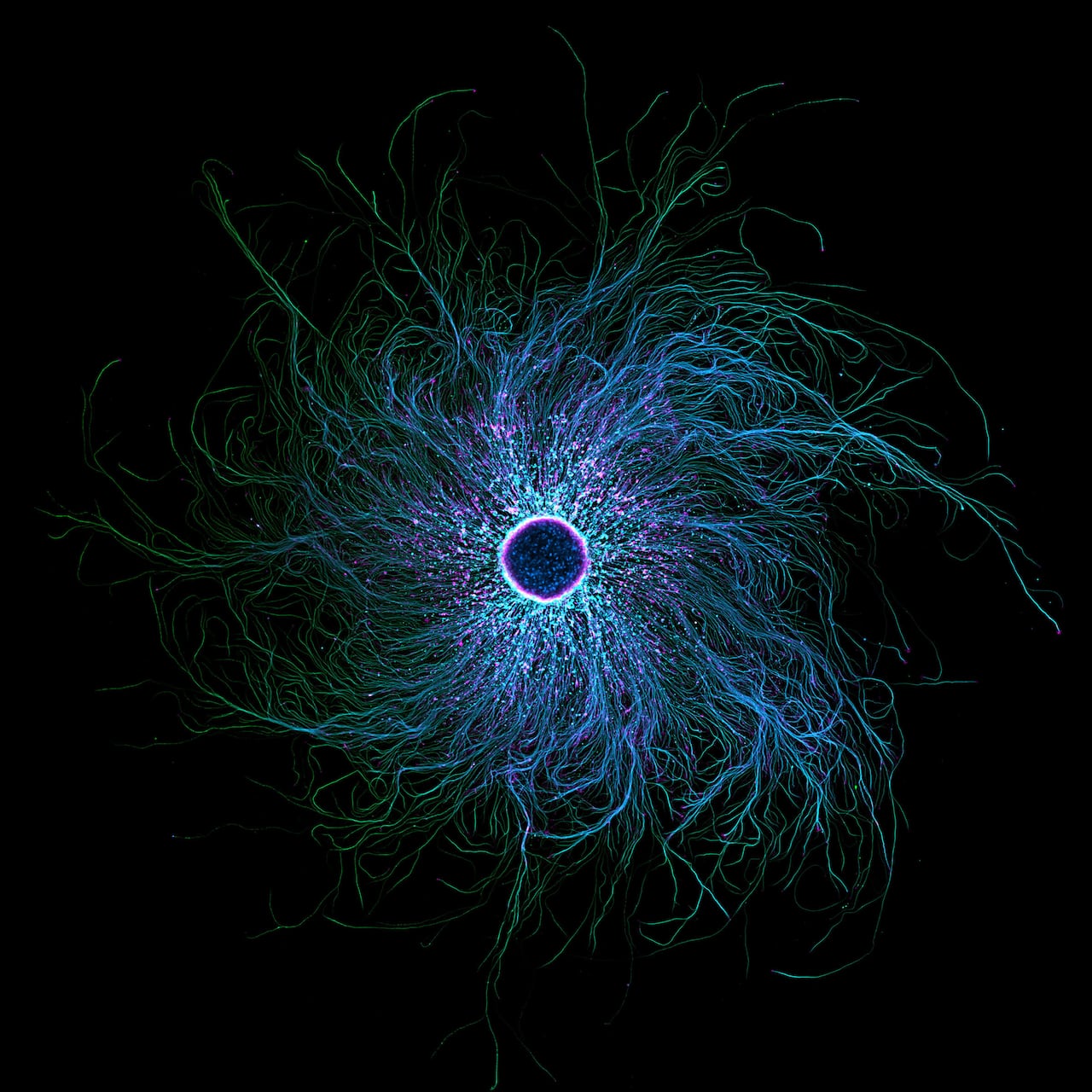 2025년 니콘 스몰 월드 현미경 사진전 7등작, 유도만능줄기세포 유래 감각 뉴런,Stella Whittaker/Nikon Small World