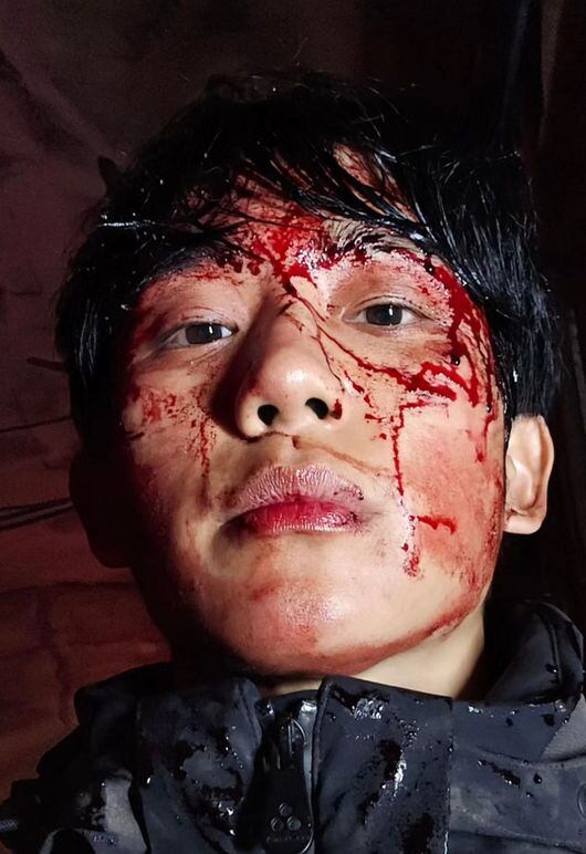 정해인 얼굴에 무슨 일?! 피범벅으로 인사 전한 '안녕'